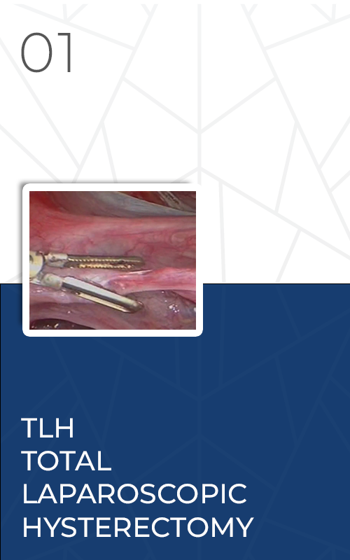 dc43-dpd-tlh