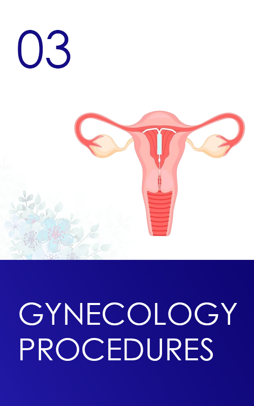 gynecology-procedures